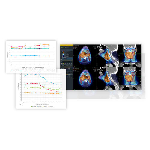 Software per radiologia - PreciseART® - Accuray - di analisi di dati / per reportistica / di pianificazione