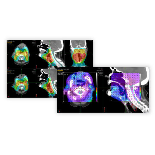 Software per tomografia computerizzata - PreciseRTX® - Accuray - di gestione della dose irradiata / di pianificazione del trattamento / per tablet PC