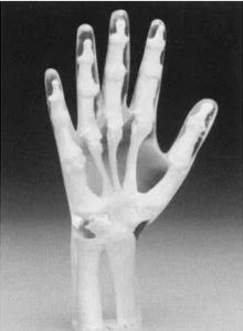 Phantom di calibrazione per radiografia - Capintec - mano