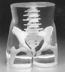 Phantom di calibrazione per radiografia - Capintec - di addome