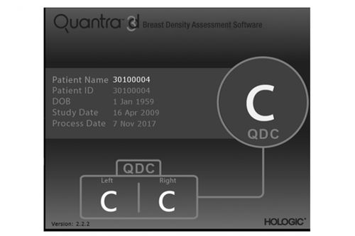 Software per mammografia - Quantra™ - Hologic - medico / per reportistica / CAD