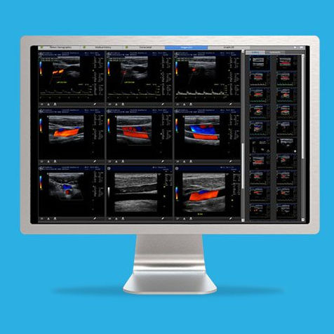 Software di visualizzazione 3D - ViewPoint™ 6 - GE Healthcare - per reportistica / di misura / di post elaborazione