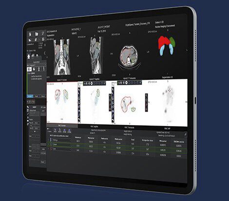Applicazione android per comunicazioni - Xeleris V - GE Healthcare - di misura / di analisi / per medicina nucleare
