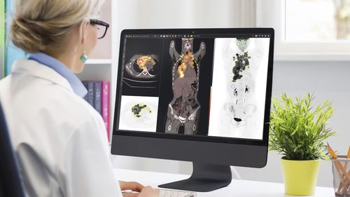 Software di trattamento - MIM™ - GE Healthcare - di pianificazione / di pianificazione del trattamento / medico