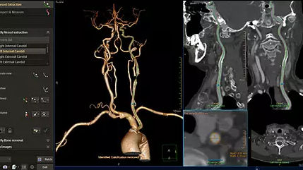 Software di analisi - IntelliSpace Portal 12 - Philips Healthcare - di gestione / di visualizzazione / diagnostico