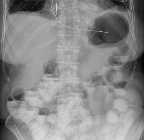 Software di visualizzazione - UNIQUE 2 - Philips Healthcare - diagnostico / di monitoraggio di dosi di radiazioni / di pianificazione