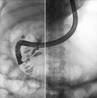 Software di ottimizzazione delle immagini - Dynamic UNIQUE - Philips Healthcare - diagnostico / medico / per radiografia