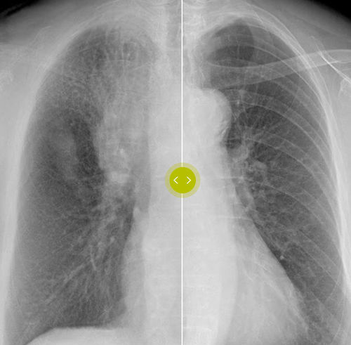 Software di ottimizzazione delle immagini - Philips Healthcare - medico / per radiografia / osseo