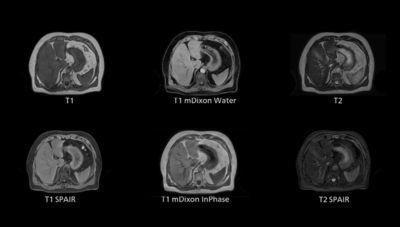 Software di simulazione - 4D MR-RT - Philips Healthcare - di riconoscimento dei contorni / di pianificazione del trattamento / medico