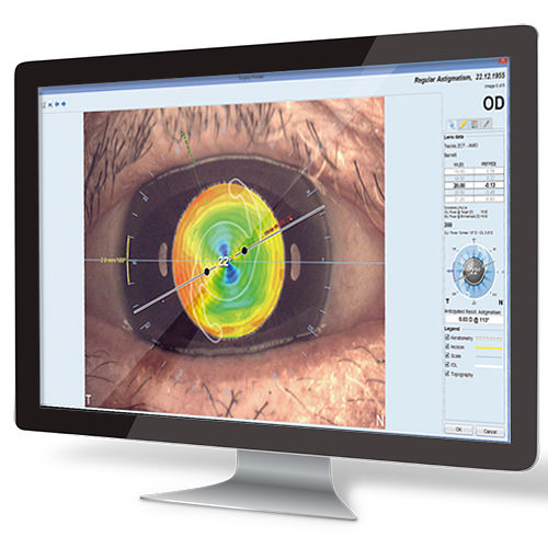 Software di pianificazione - EyeSuite IOL  - Haag-Streit Diagnostics - di misura / per chirurgia oftalmica / di anatomia