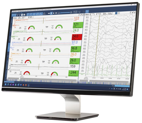 Software medico - Moberg CNS - Natus Hearing & Balance - clinico / per terapia intensiva / di analisi