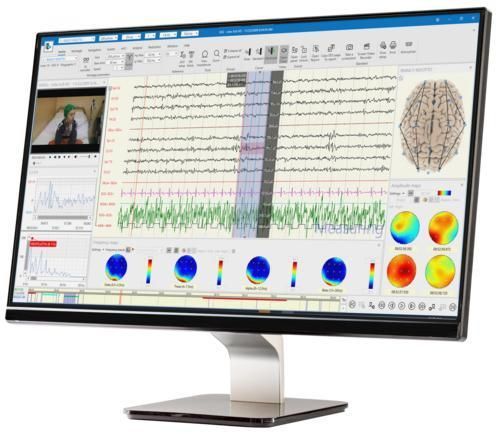 Sistema di gestione e analisi di visualizzazione - BRAIN QUICK® - Natus Hearing & Balance - di file DICOM / diagnostico / di segnali