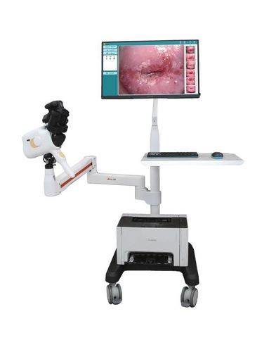Colposcopio digitale - V1-V2 - Guangzhou Sunray Medical Equipment Co., Ltd. - su carrello