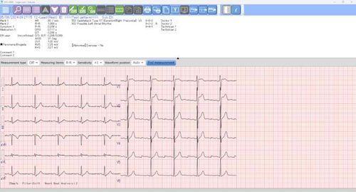 Sistema di gestione dell'informazione - EFS-1000 - Fukuda Denshi - di dati / diagnostico / per ospedale