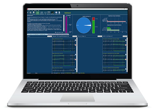 Software di rilevamento - Lifescreen Pro - Spacelabs Healthcare - per cartelle cliniche elettroniche / per Holter cardiaco / di analisi