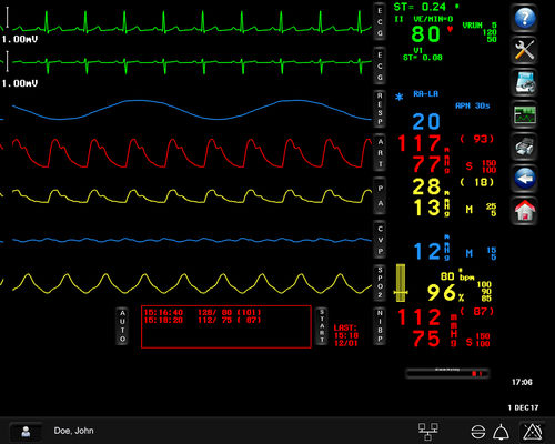 Software per sala operatoria - Spacelabs Healthcare - di monitoraggio / di misura / di allarme