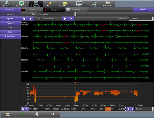 Software di visualizzazione - Smart Disclosure - Spacelabs Healthcare - di sincronizzazione dell'ora / di allarme / per ECG