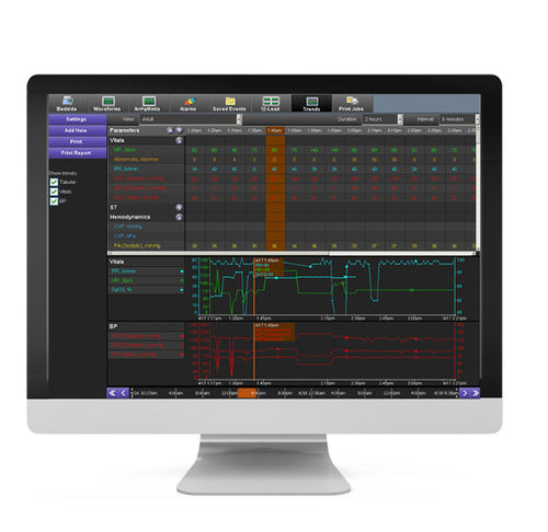 Algoritmo di analisi - Spacelabs Healthcare - di gestione dati / di monitoraggio / clinico