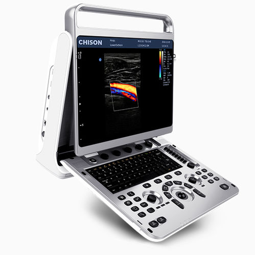 Ecografo portatile - EBit 20 - CHISON Medical Technologies - per ecografia multidisciplinare / per ecografia ginecologica ed ostetrica / per ecografia addomino-pelvica