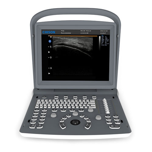 Ecografo portatile - ECO 2 - CHISON Medical Technologies - per ecografia muscolo-scheletrica / in bianco e nero / con console integrata