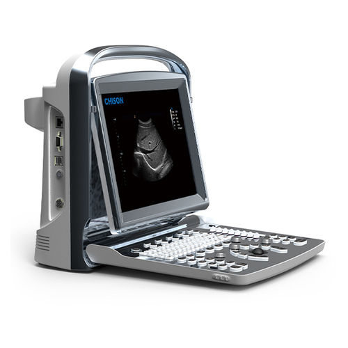 Ecografo portatile - ECO 1 - CHISON Medical Technologies - per ecografia multidisciplinare / in bianco e nero / con console integrata