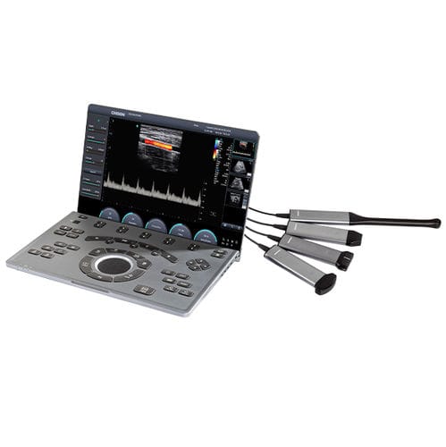 Ecografo portatile - SonoAir 30 - CHISON Medical Technologies - per ecografia multidisciplinare / per ecografia ginecologica ed ostetrica / per ecografia cardiovascolare