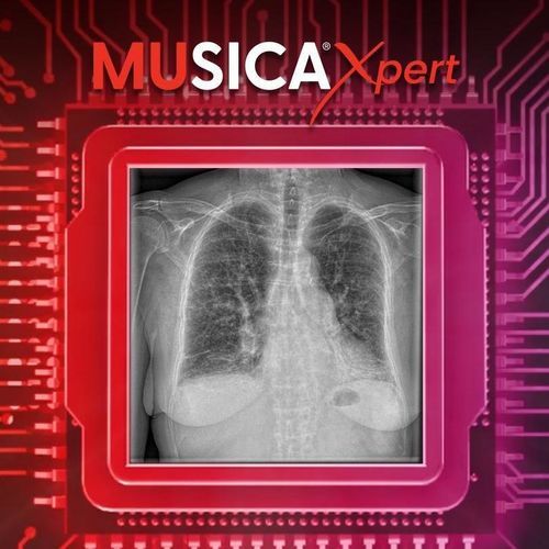 Sistema di post trattamento per il settore medico - MUSICA Xpert™ - AGFA