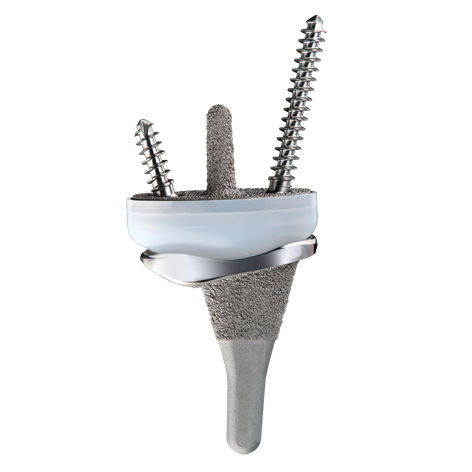 Protesi di polso cementata - FREEDOM - Smith & Nephew