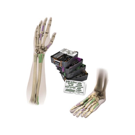 Placca di compressione per mano - VLP™ MINI-MOD™ - Smith & Nephew - per articolazione metatarso-falangea / per polso / per caviglia