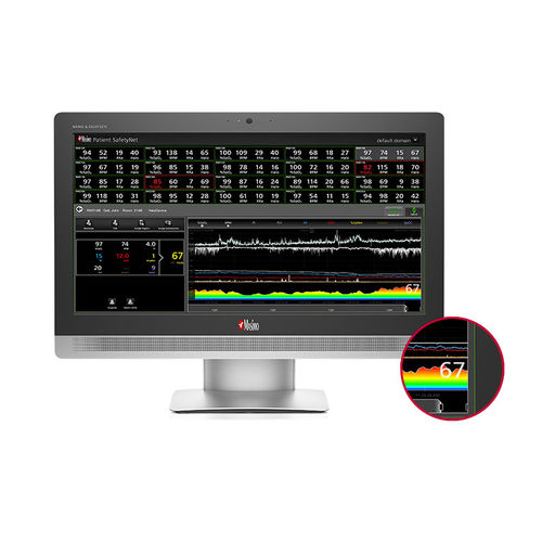 Software per ospedale - Halo ION - Masimo - per cartelle cliniche elettroniche / di gestione dati / per tablet PC