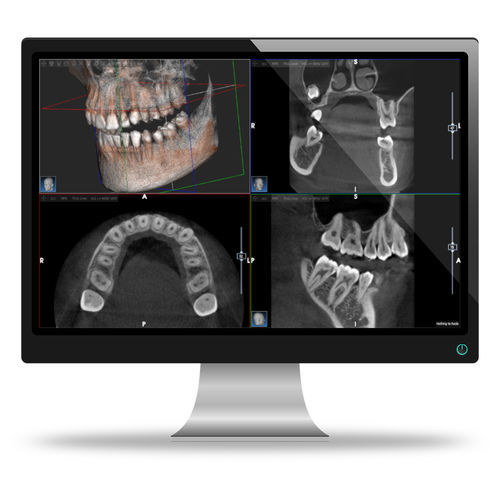 Software odontoiatrico - AIS - ACTEON GROUP - per diagnostica per immagini / per imaging odontoiatrico / clinico