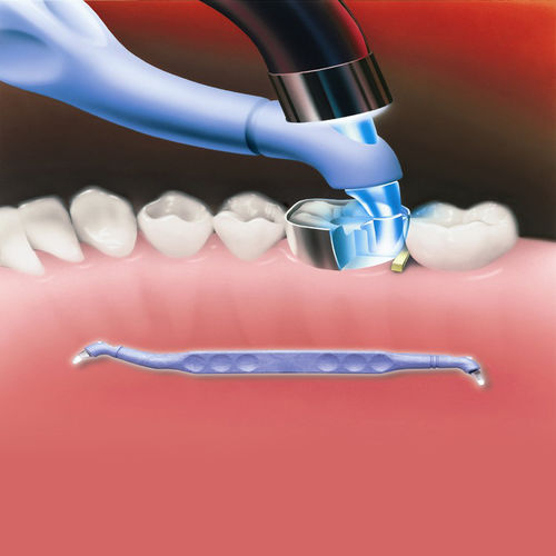 Polimerizzatrice odontotecnico - Trimax™ - AdDent, Inc.  