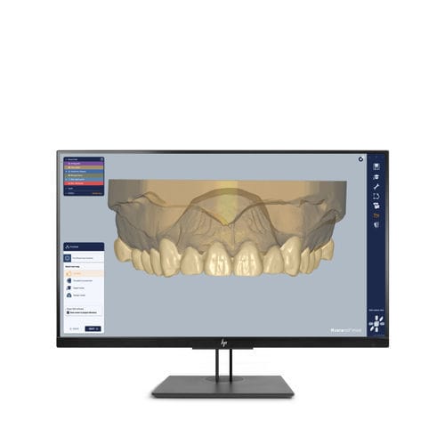 Software da laboratorio - Ceramill Mind - Amann Girrbach - odontoiatrico / CAD / di progettazione di protesi dentale