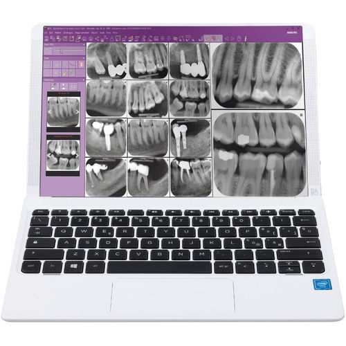 Software di controllo - iRYS - Anthos   - visualizzatore / diagnostico / di registrazione