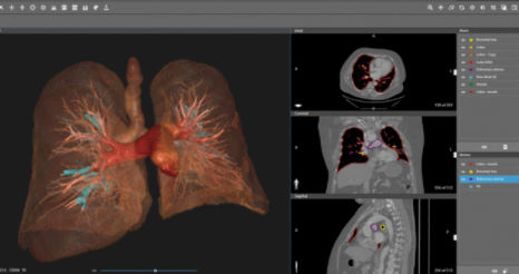 Software point of care - D2P® - 3D Systems - per diagnostica per immagini / preoperatorio / per ospedale
