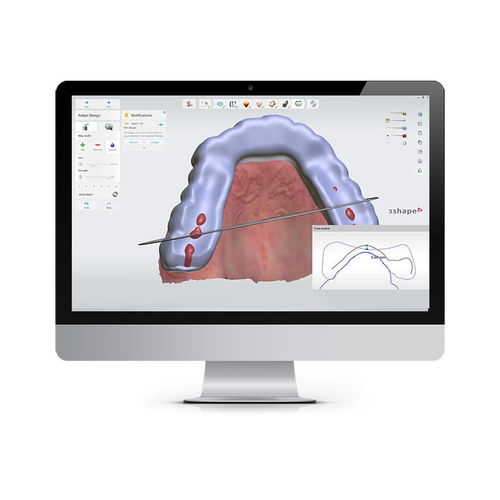 Software di controllo - SPLINT STUDIO - 3shape - odontoiatrico / ortodontico / di trattamento