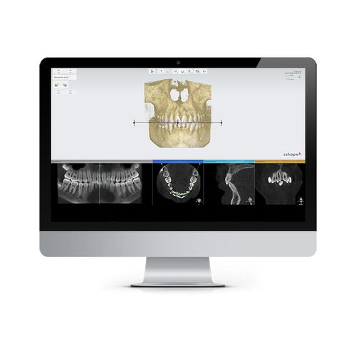 Software di pianificazione del trattamento - Ortho Planner - 3shape - clinico / ortodontico / di analisi