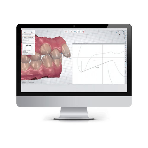 Software ortodontico - ALIGNER STUDIO - 3shape - di analisi / di gestione / di pianificazione del trattamento
