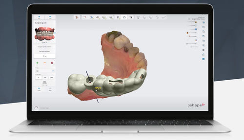 Software clinico - Implant Studio™ - 3shape - per implantologia dentale / per studio odontoiatrico / chirurgico