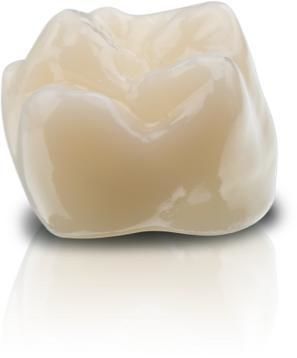 Materiale odontoiatrico ibrido - VarseoSmile&reg; Crown plus - BEGO - in ceramica ibrida / in resina / per corone dentali