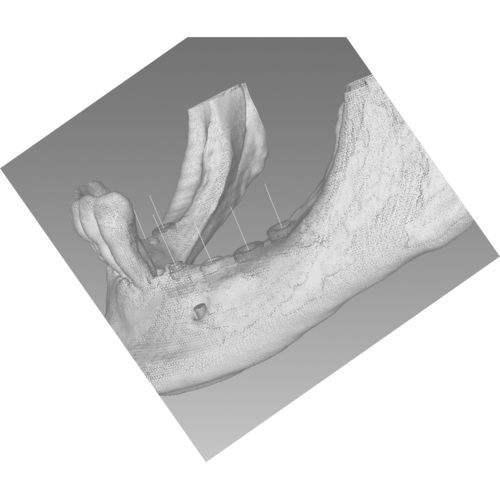 Software di visualizzazione - BTI Scan 4 - BTI Biotechnology Institute - diagnostico / di misura / di pianificazione