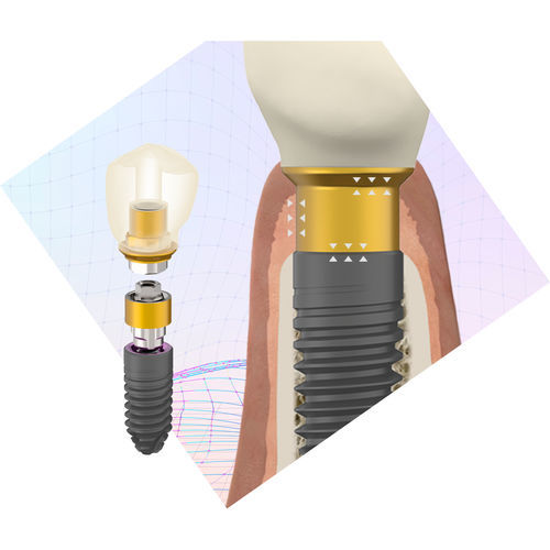 Pilastro dentale per impianto cilindrico - BioBlock® - BTI Biotechnology Institute - in titanio / esterno / dritto