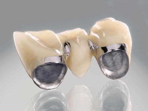 Materiale odontoiatrico in ceramica - remanium® secura - DENTAURUM - CoCr / per ponti dentali / per corone dentali