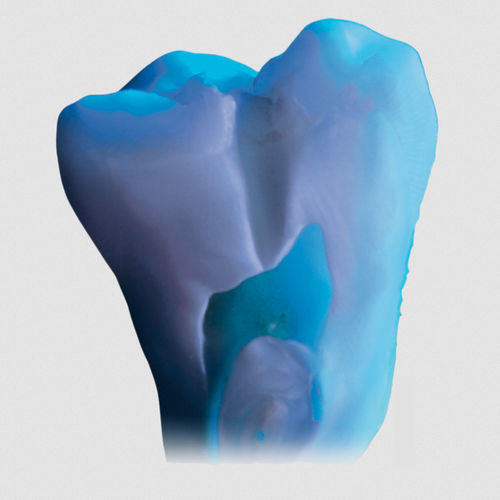 Materiale odontoiatrico in ceramica - ceraMotion® Me - DENTAURUM - per stratificazione in ceramica / traslucido / opaco