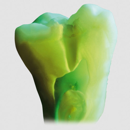 Materiale odontoiatrico in ceramica - ceraMotion® Zr - DENTAURUM - per stratificazione in ceramica / pasta / trasparente