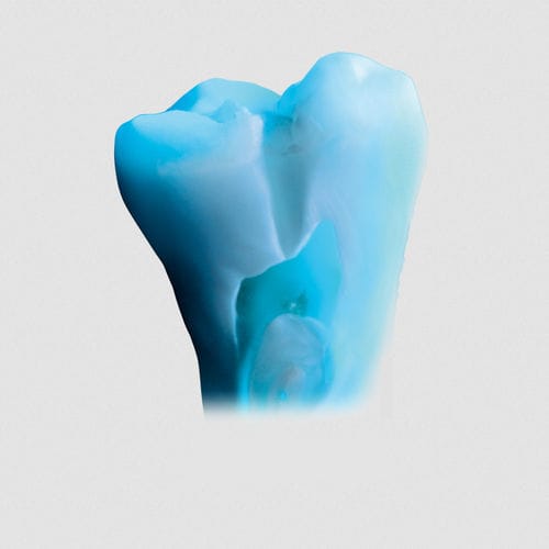 Materiale odontoiatrico in ceramica - ceraMotion® Ti - DENTAURUM - per stratificazione in ceramica / traslucido