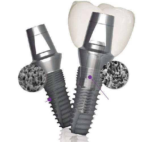 Impianto dentale conico - Implantium II  - Dentium - in titanio / ad esagono interno
