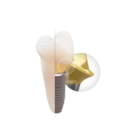 Pilastro dentale per impianto in titanio - Atlantis&reg; - DENTSPLY Implants GmbH - esterno / dritto / angolare