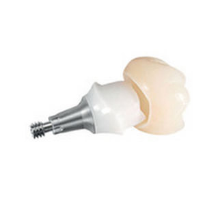Pilastro dentale per impianto in titanio - ANKYLOS® TitaniumBase - DENTSPLY Implants GmbH - interno / dritto