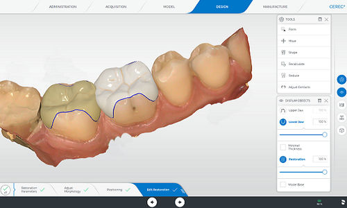 Software per laboratorio dentale - CEREC - DENTSPLY MAILLEFER - ortodontico / di analisi / di monitoraggio